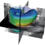 Mécanique en cardiologie : simulation cardiaque par IRM