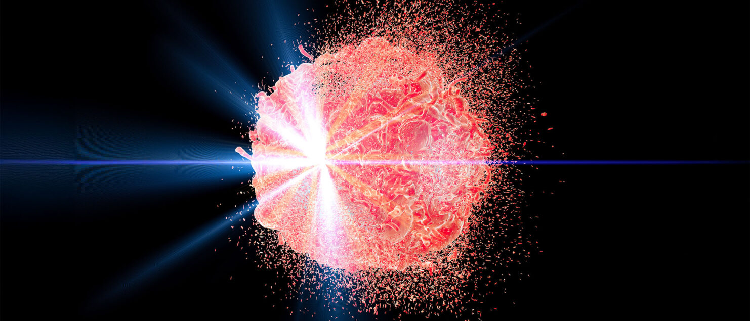 Accélérateurs Laser-Plasma : une nouvelle ère pour la radiothérapie