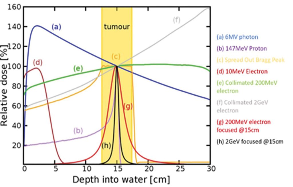 Dans le cas d’une tumeur profonde située 15 cm à l’intérieur du corps, la figure montre différents types de rayonnement : courbe (g) électrons focalisés à haute énergie.